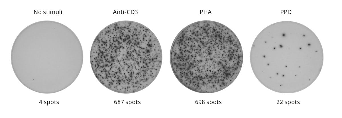 T cell ELISpot