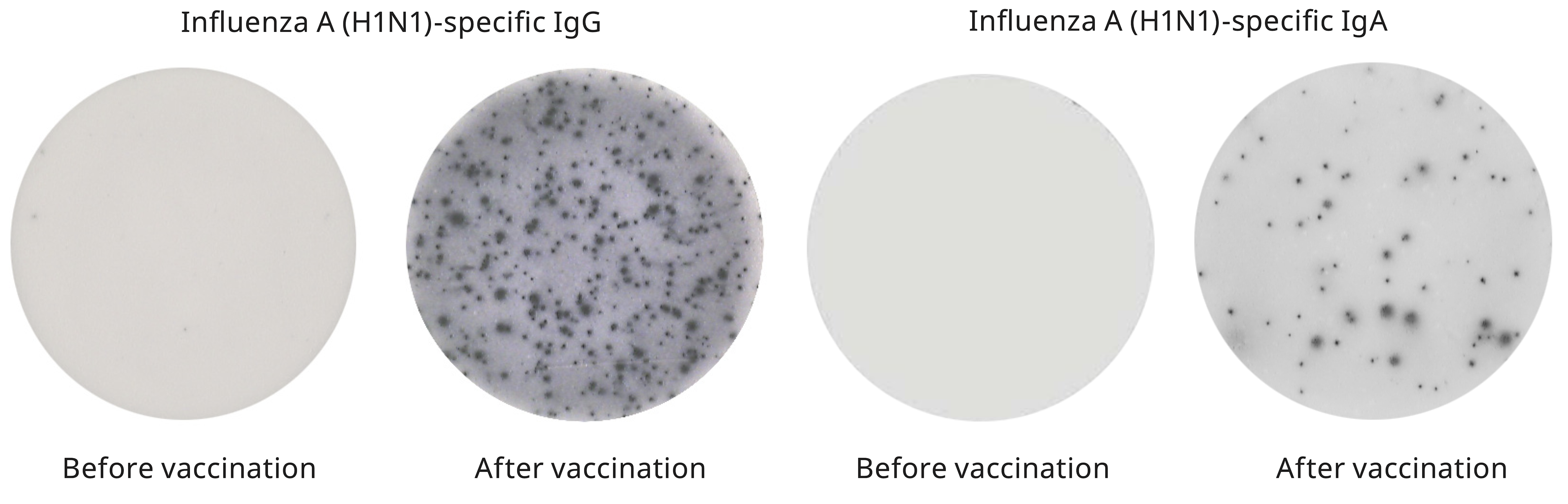 Human IgG and IgA ELISpot