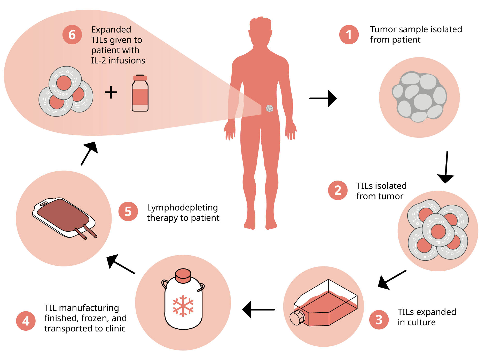 TIL isolation, expansion, delivery, and infusion with IL-2 into cancer patients