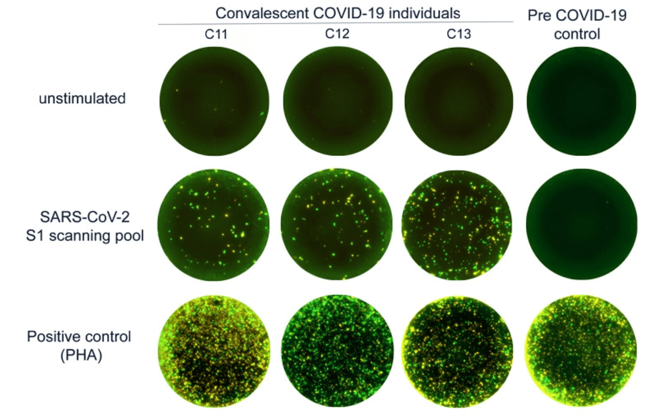 FluoroSpot wells depicting IFN‑γ/IL‑2 responses in convalescent COVID-19 patient samples stimulated with a S1+SNMO peptide pool