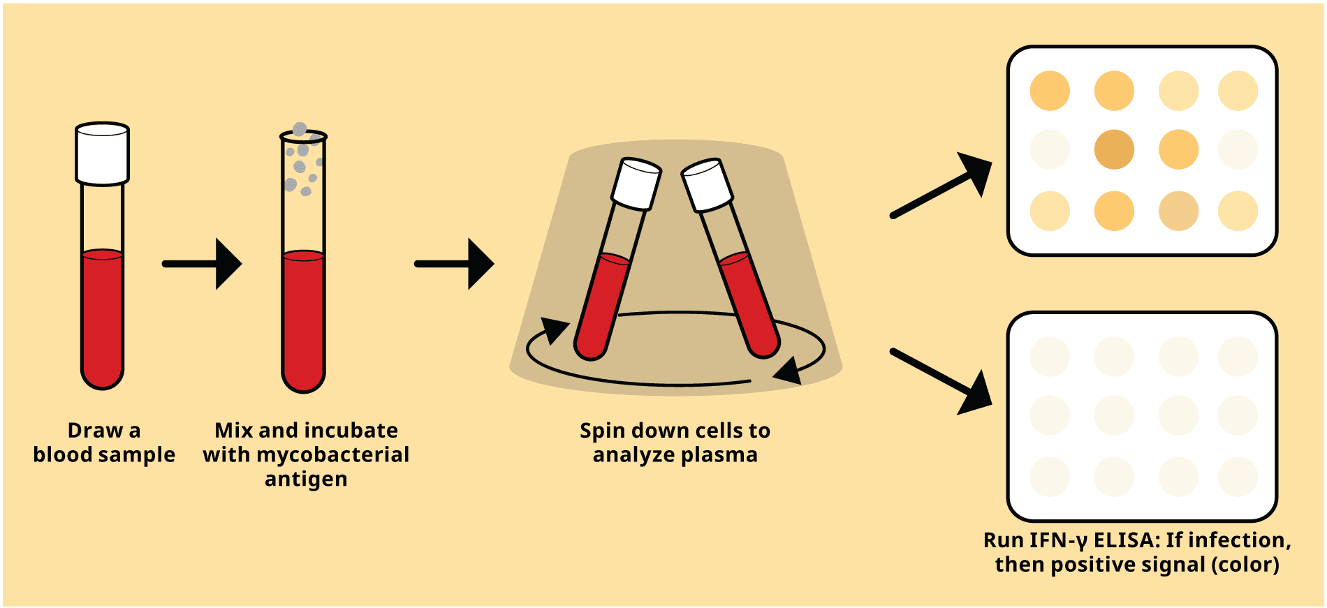 ELISA-based TB diagnostics