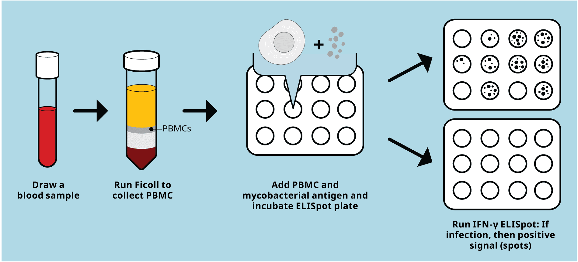 ELISpot-based TB diagnosis