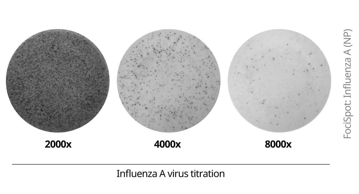 FociSpot immunostaining of influenza A nucleoprotein in infected MDCK cells. MDCK cells were infected with influenza A virus (titrated, virus dilutions 2,000x, 4,000x, and 8,000x are shown). After fixation and permeabilization, foci were detected using anti-influenza A (NP) mAb 19C10, followed by Streptavidin-ALP and BCIP/NBT-plus substrate. Foci were counted using the Apex software in Mabtech IRIS 2.